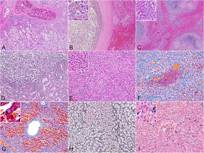 Histochemical and Immunohistochemical Characterizations of Hepatic Trematodiasis in Odontocetes